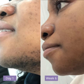 Anuae Skin Cyperus Rotundus Serum