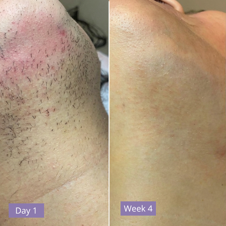 Anuae Skin Cyperus Rotundus Serum