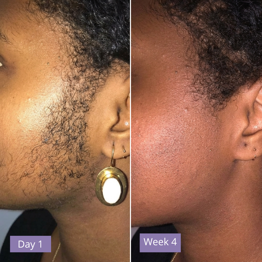 Anuae Skin Cyperus Rotundus Serum