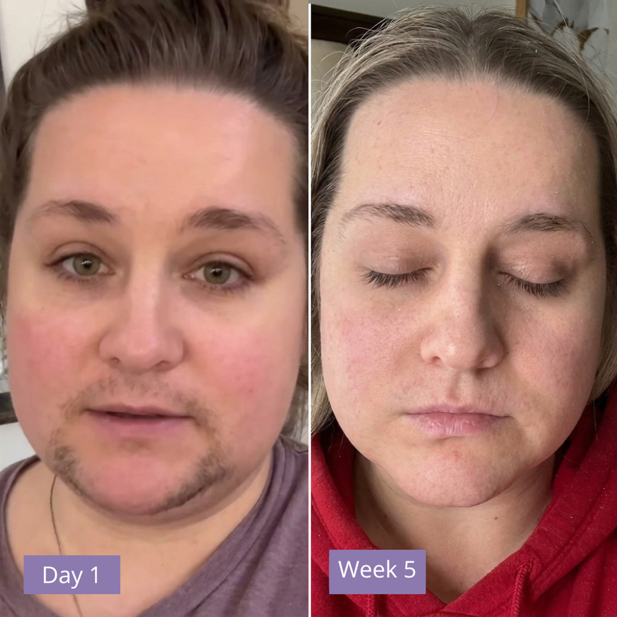 Anuae Skin Cyperus Rotundus Serum