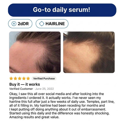 Deoxyribose Scalp Serum™