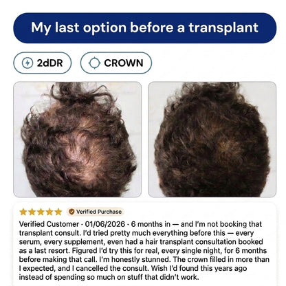 Deoxyribose Scalp Serum™